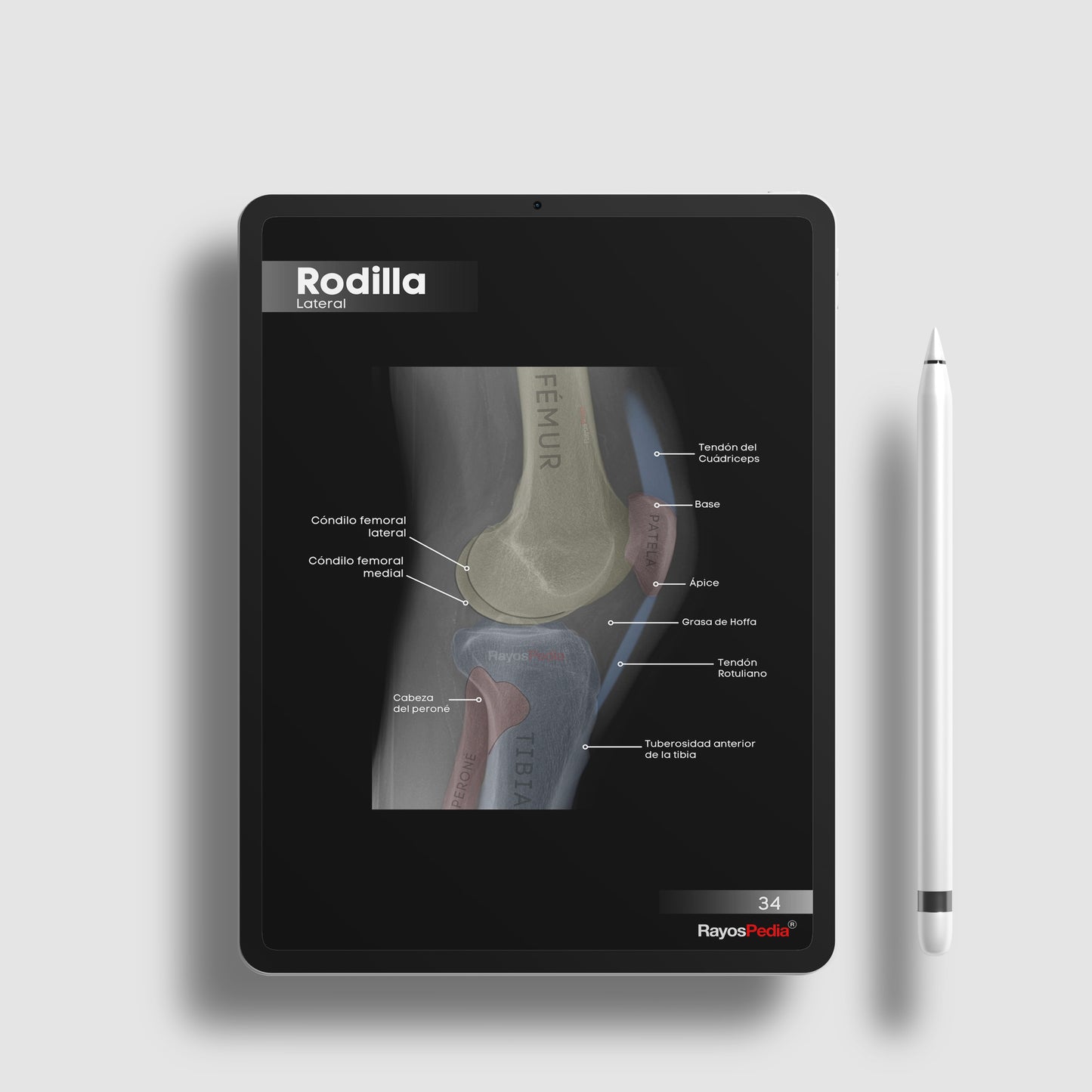 Atlas de Anatomía Radiológica