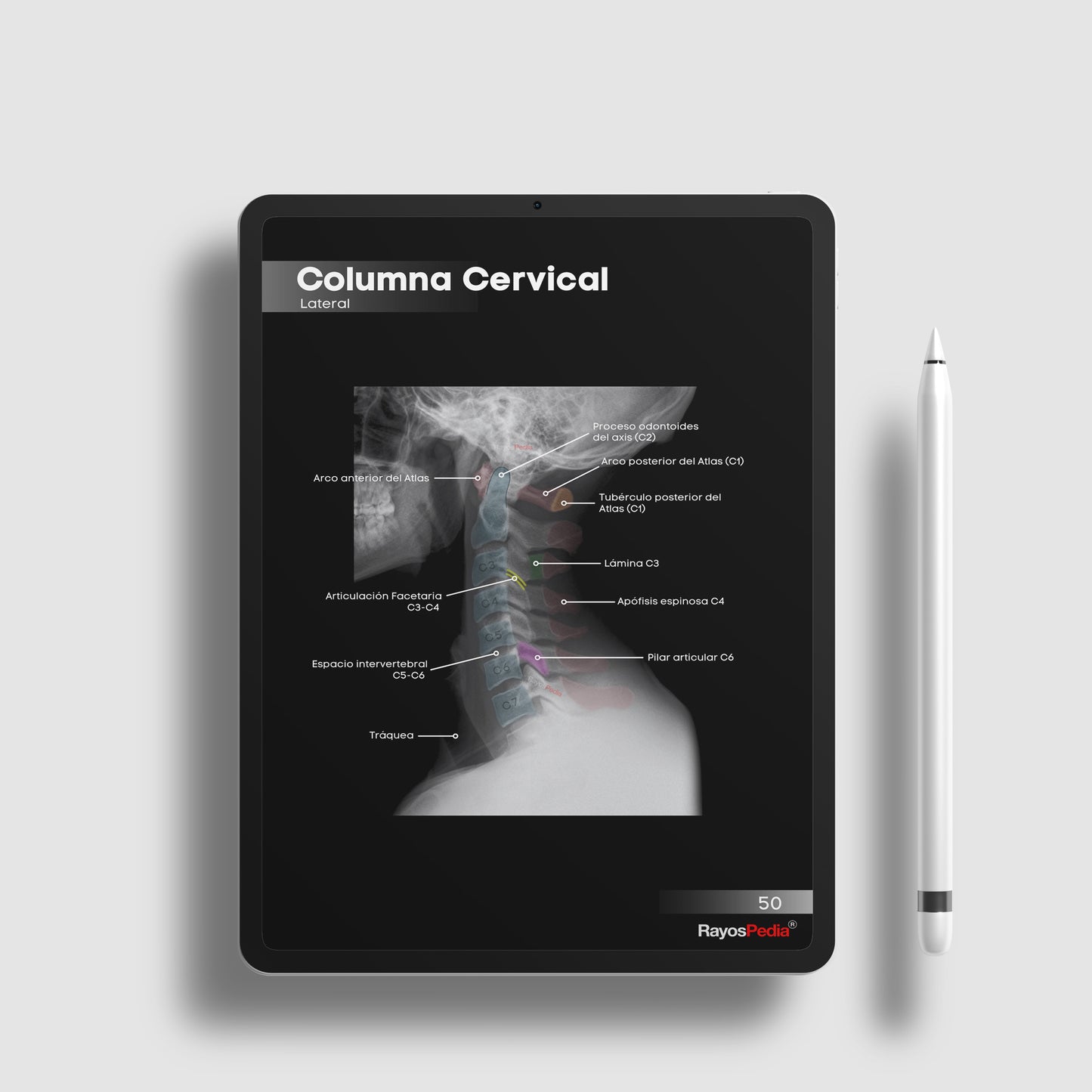 Atlas de Anatomía Radiológica