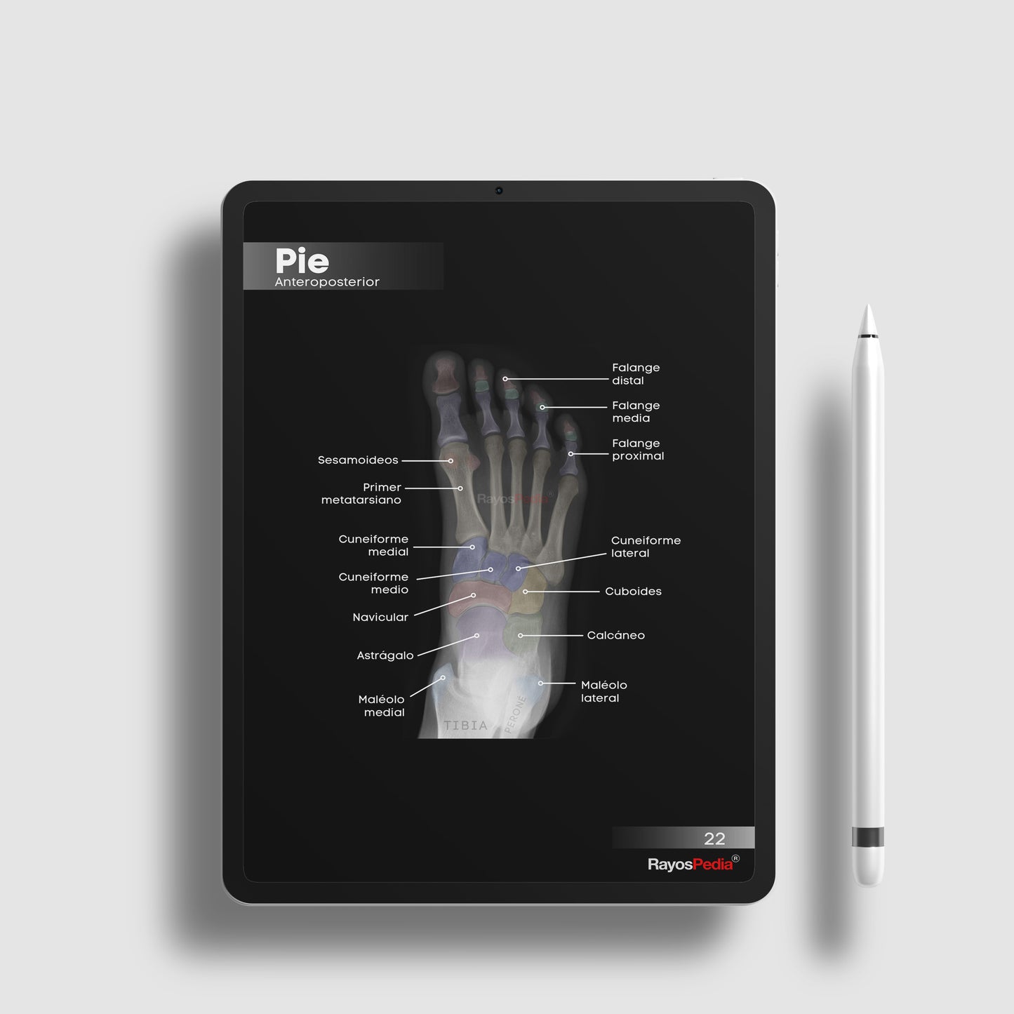 Atlas de Anatomía Radiológica