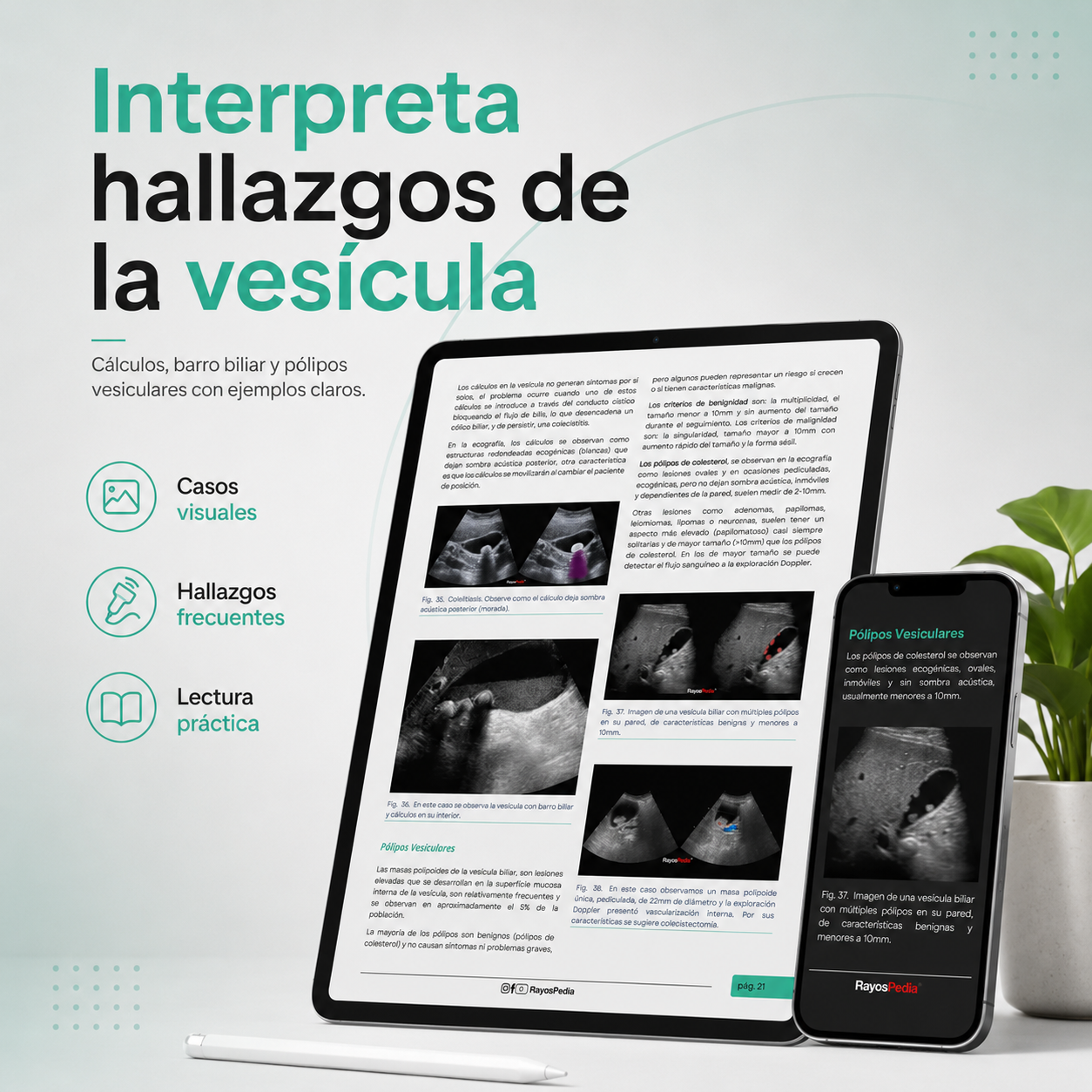 El ABC de la Ecografía Abdominal