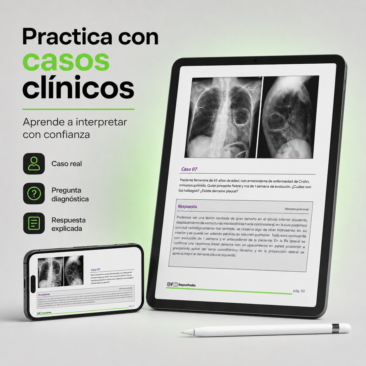 El ABC de la Radiografía de Tórax