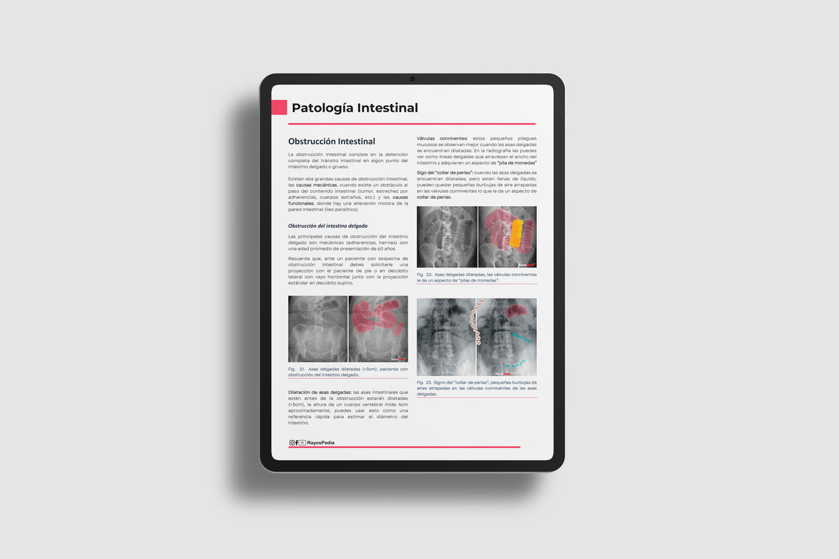 Abc Radiografía El ABC de la Radiografía de Abdomen – Rayospedia