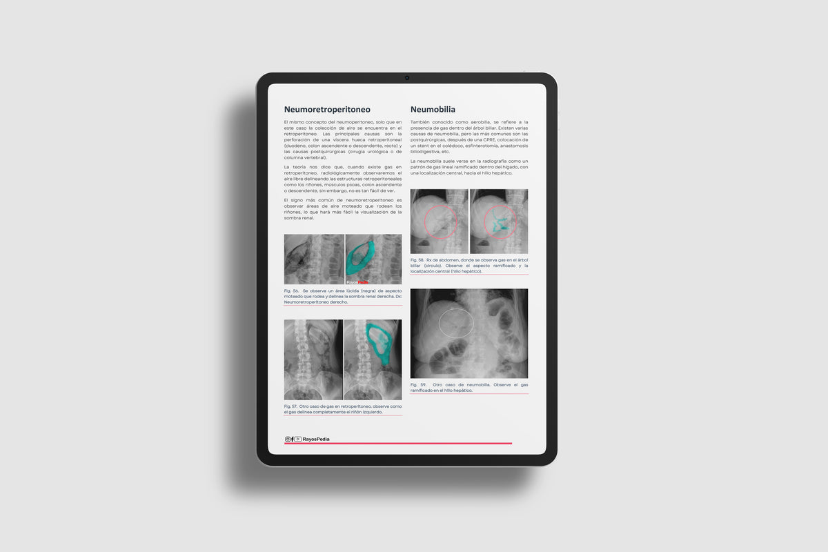 Abc Radiografía El ABC de la Radiografía de Abdomen – Rayospedia