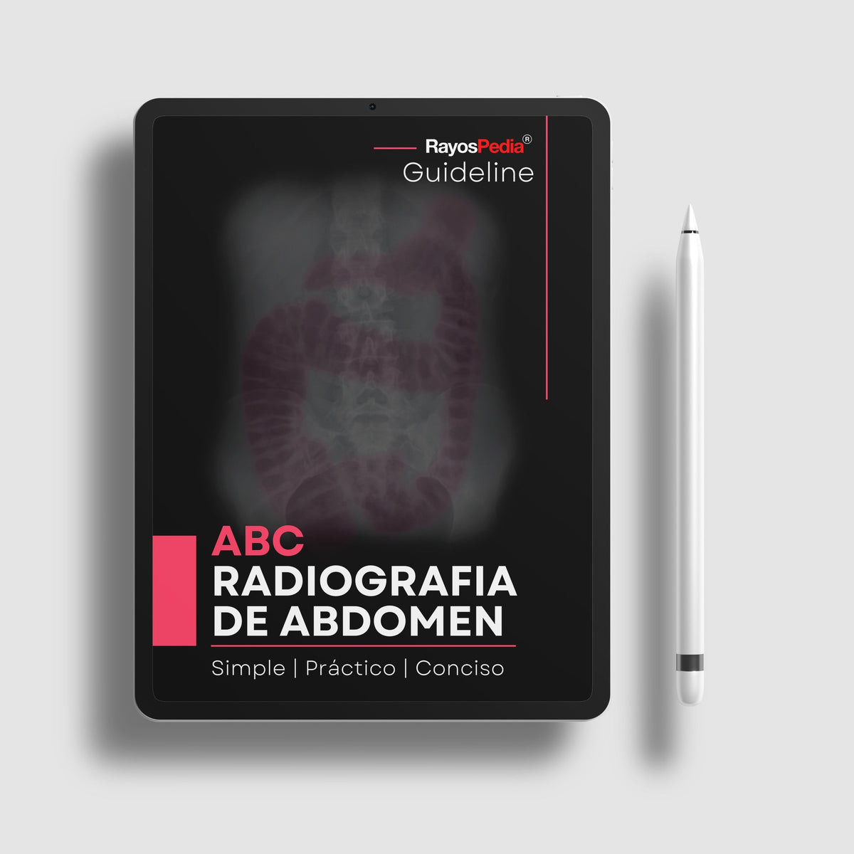 Abc Radiografía El ABC de la Radiografía de Abdomen – Rayospedia