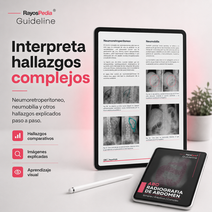 El ABC de la Radiografía de Abdomen