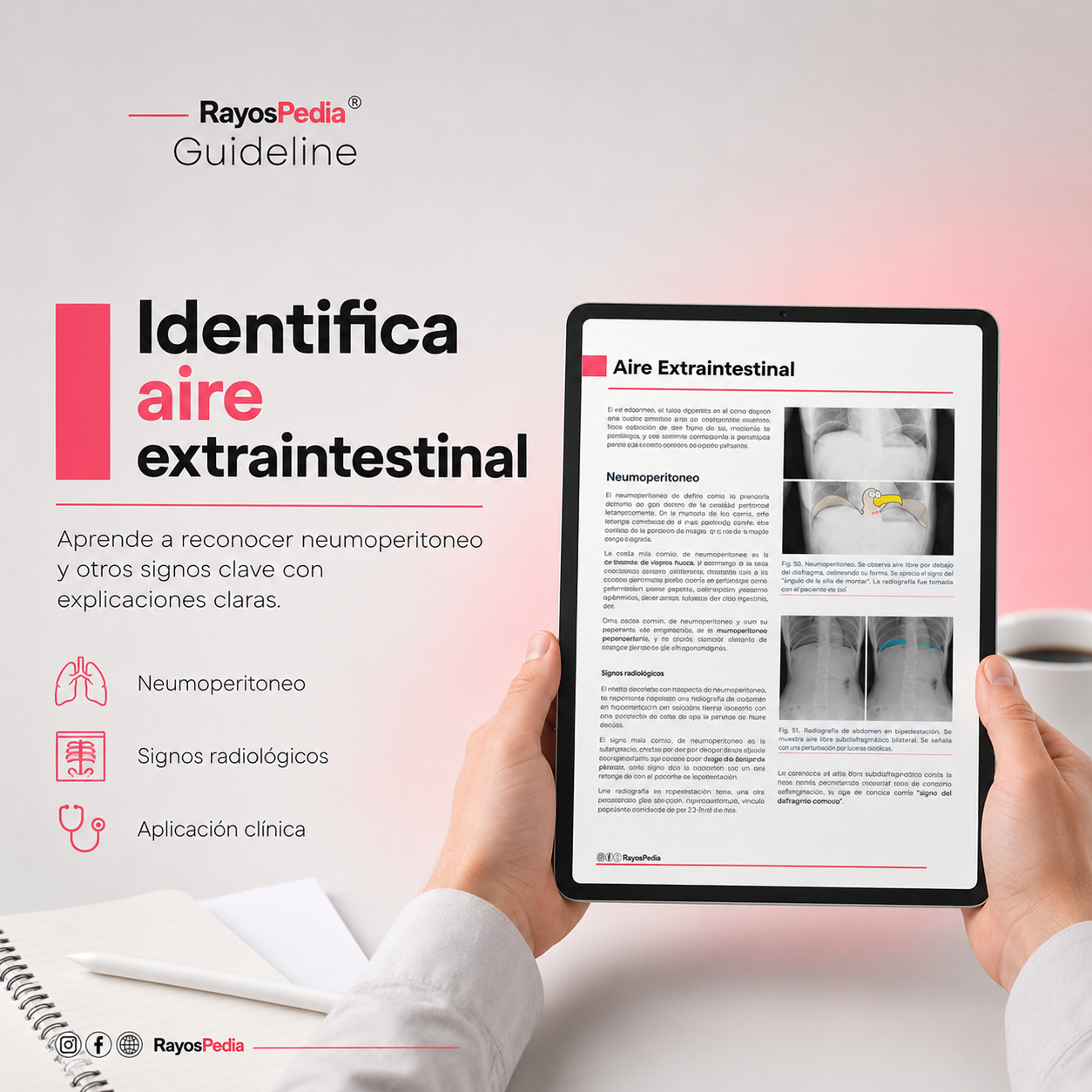 El ABC de la Radiografía de Abdomen