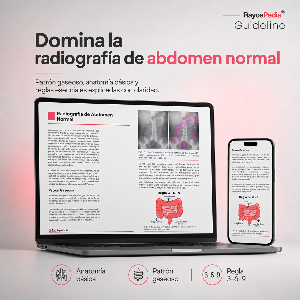 El ABC de la Radiografía de Abdomen