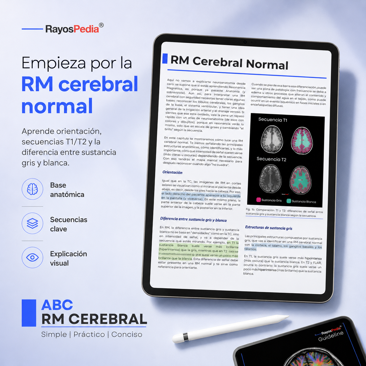 El ABC de la RM Cerebral