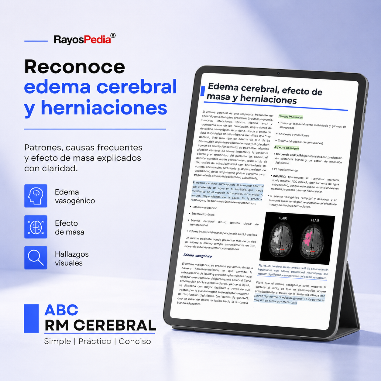 El ABC de la RM Cerebral