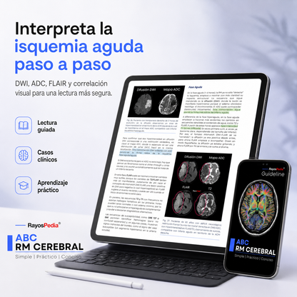 El ABC de la RM Cerebral
