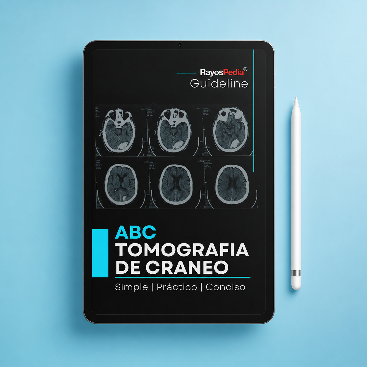 El ABC de la Tomografía de Cráneo