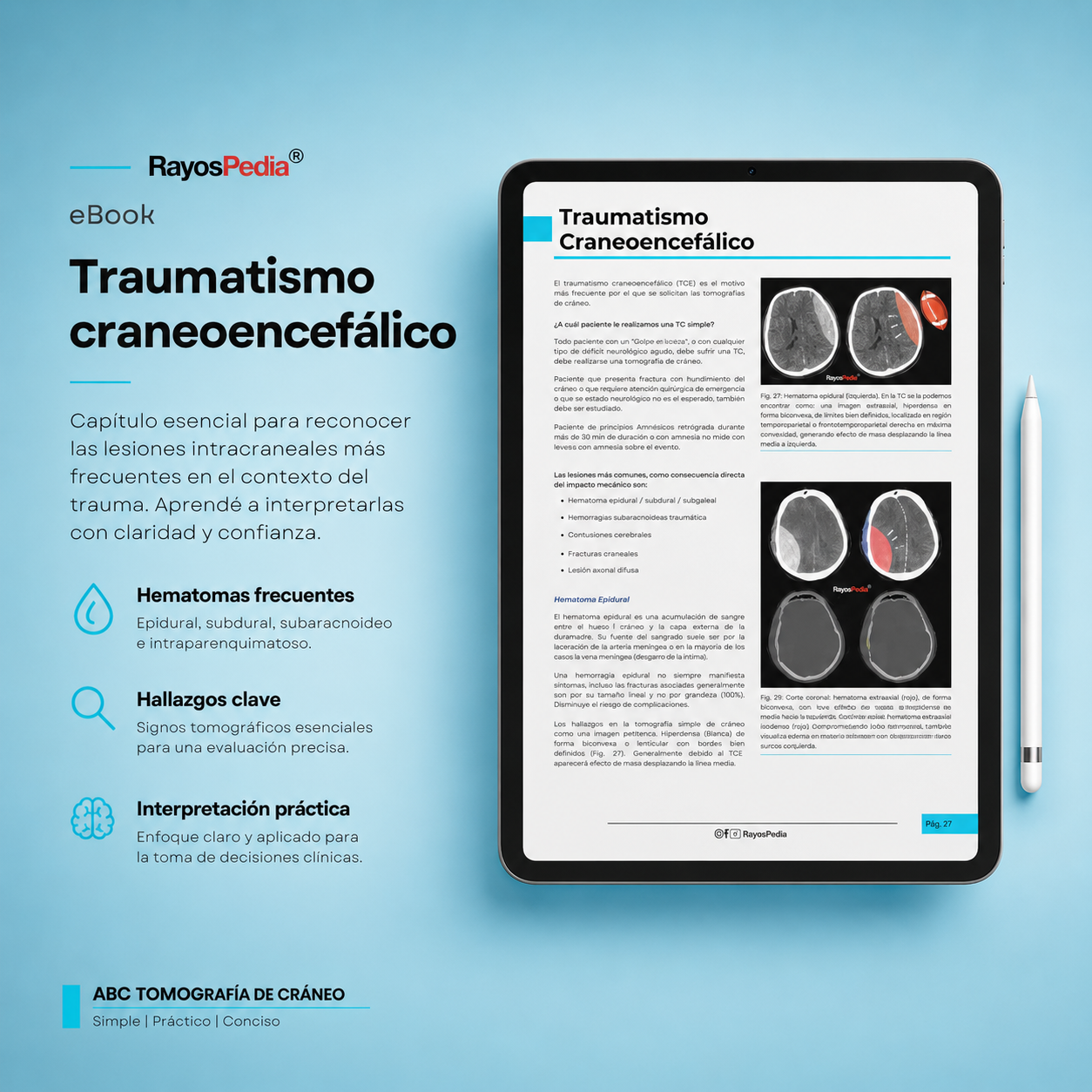 El ABC de la Tomografía de Cráneo